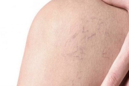 5fceb57e-2d4c-4421-ac7a-3a98ac1e0123