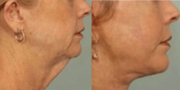 Design sem nome (27)