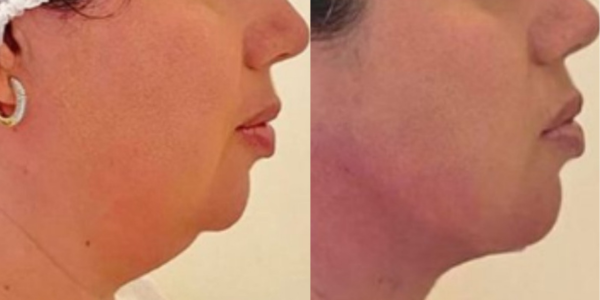 Design sem nome (28)