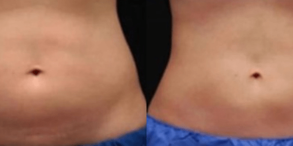 Design sem nome (31)